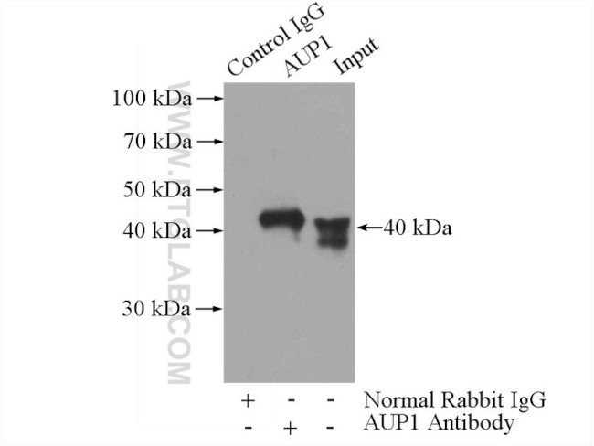 AUP1 Antibody in Immunoprecipitation (IP)
