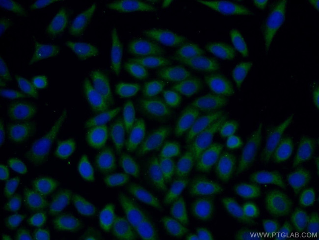 Trefoil factor 1 Antibody in Immunocytochemistry (ICC/IF)