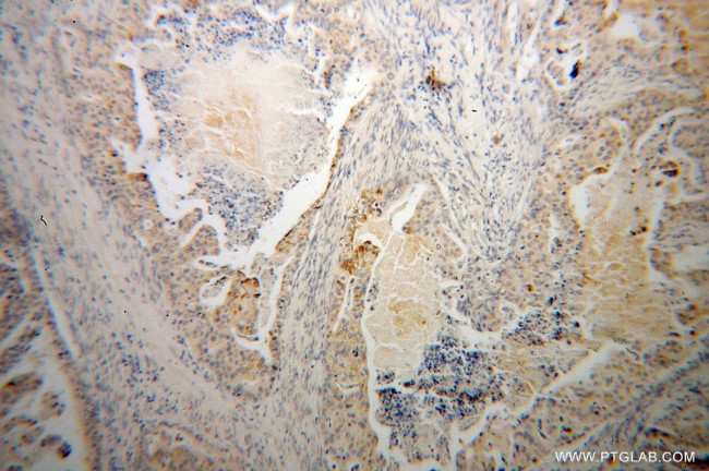 Trefoil factor 1 Antibody in Immunohistochemistry (Paraffin) (IHC (P))