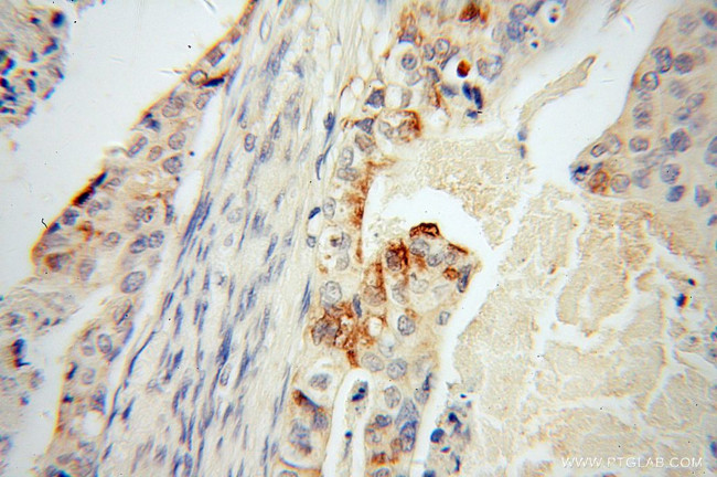 Trefoil factor 1 Antibody in Immunohistochemistry (Paraffin) (IHC (P))