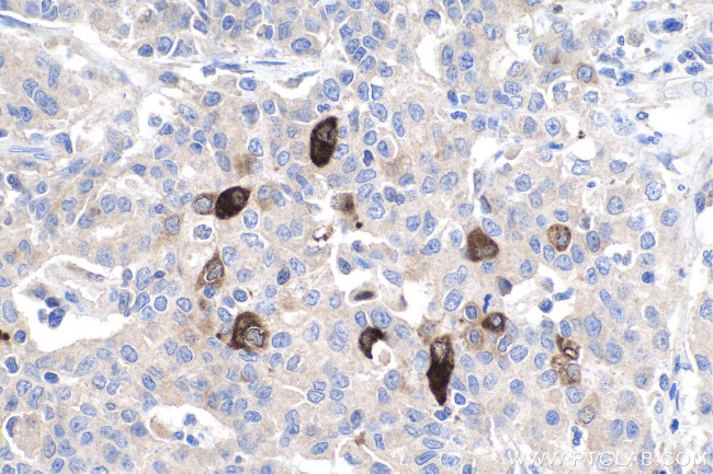 Trefoil factor 1 Antibody in Immunohistochemistry (Paraffin) (IHC (P))