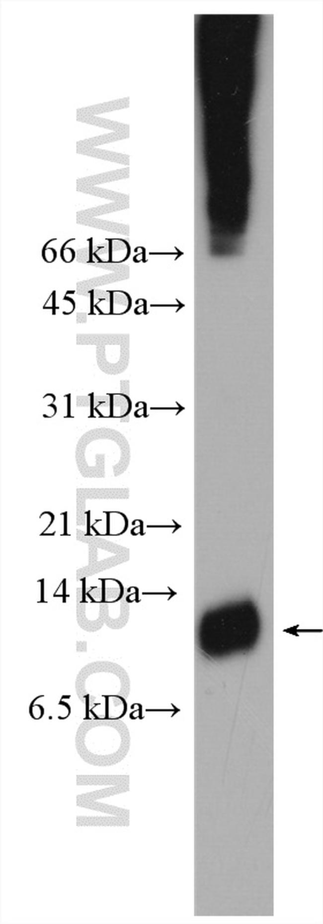 Trefoil factor 1 Antibody in Western Blot (WB)