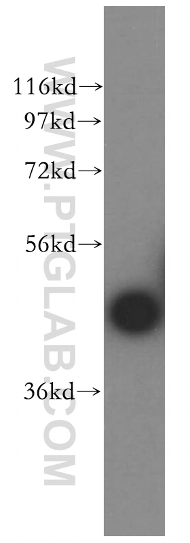 CA14 Antibody in Western Blot (WB)