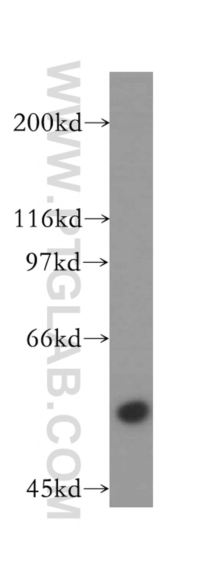 RNMT Antibody in Western Blot (WB)