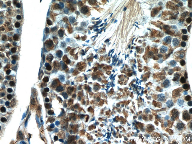 Histone H3.3 Antibody in Immunohistochemistry (Paraffin) (IHC (P))