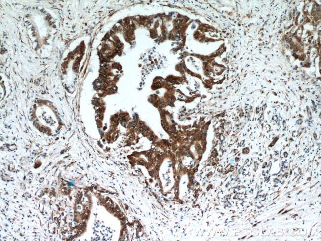 P4HA2 Antibody in Immunohistochemistry (Paraffin) (IHC (P))