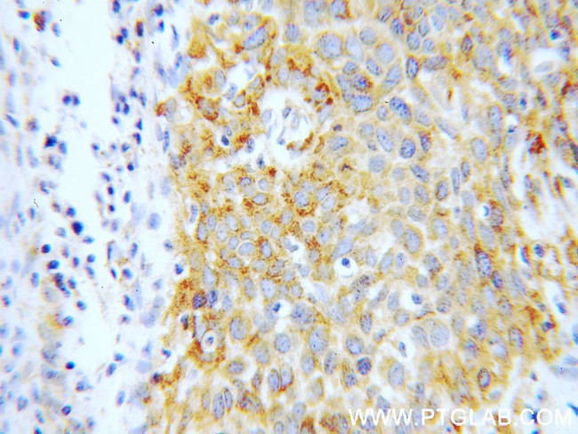 P4HA2 Antibody in Immunohistochemistry (Paraffin) (IHC (P))