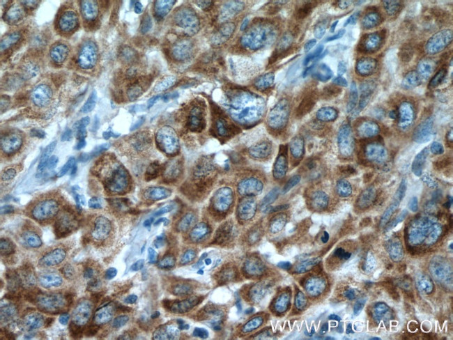 P4HA2 Antibody in Immunohistochemistry (Paraffin) (IHC (P))