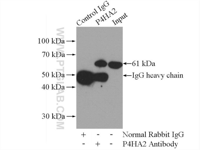 P4HA2 Antibody in Immunoprecipitation (IP)