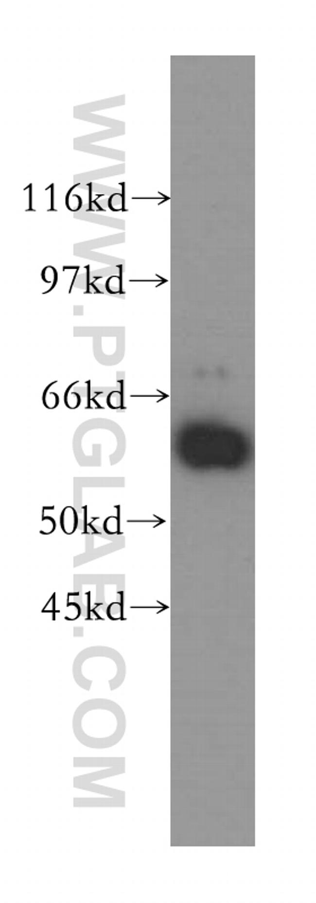 P4HA2 Antibody in Western Blot (WB)