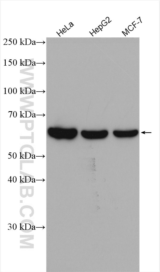 P4HA2 Antibody in Western Blot (WB)