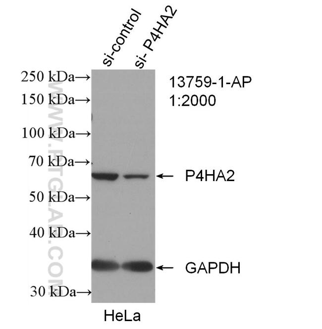 P4HA2 Antibody in Western Blot (WB)