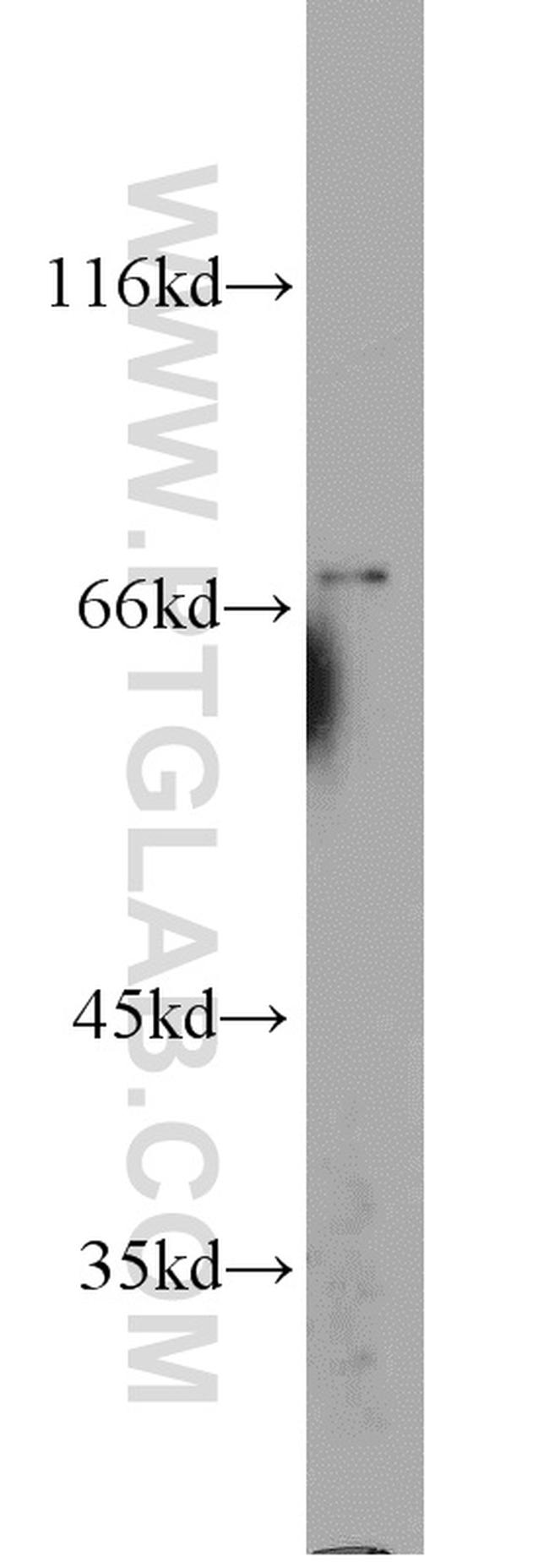 Kv4.1 Antibody in Western Blot (WB)