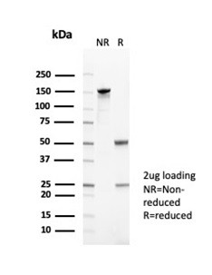 CD35/CR1 (Follicular Dendritic Cell Marker) Antibody in SDS-PAGE (SDS-PAGE)