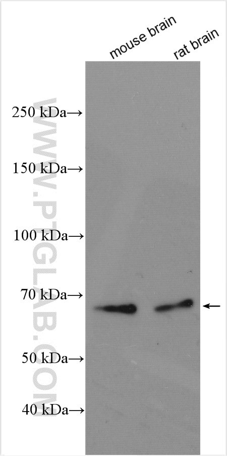 CPNE6 Antibody in Western Blot (WB)