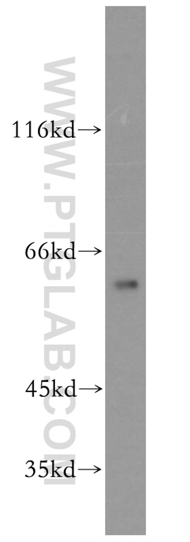 CPNE6 Antibody in Western Blot (WB)