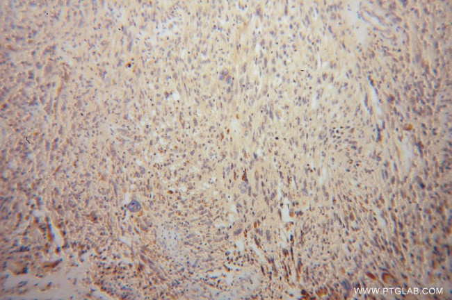 Spartin/SPG20 Antibody in Immunohistochemistry (Paraffin) (IHC (P))