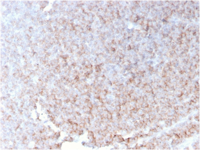 CD21 (Mature B-Cell and Follicular Dendritic Cell Marker) Antibody in Immunohistochemistry (Paraffin) (IHC (P))