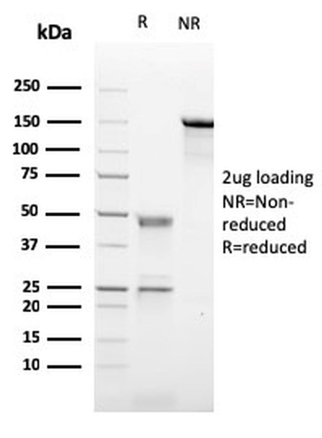 CD21 Antibody in SDS-PAGE (SDS-PAGE)