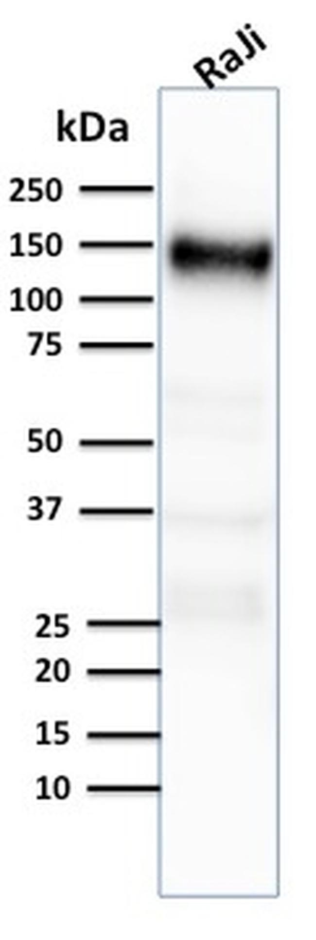 CD21 Antibody in Western Blot (WB)