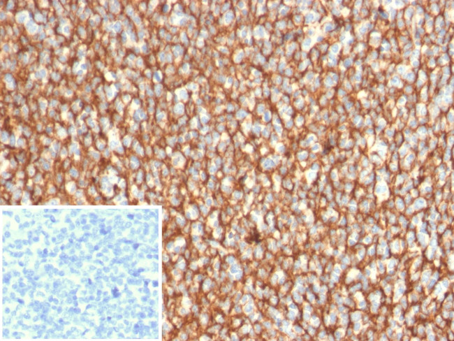 CD21 Antibody in Immunohistochemistry (Paraffin) (IHC (P))