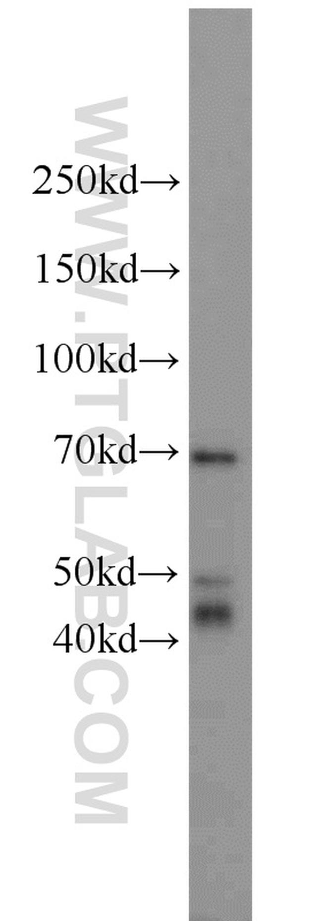 DARS2 Antibody in Western Blot (WB)