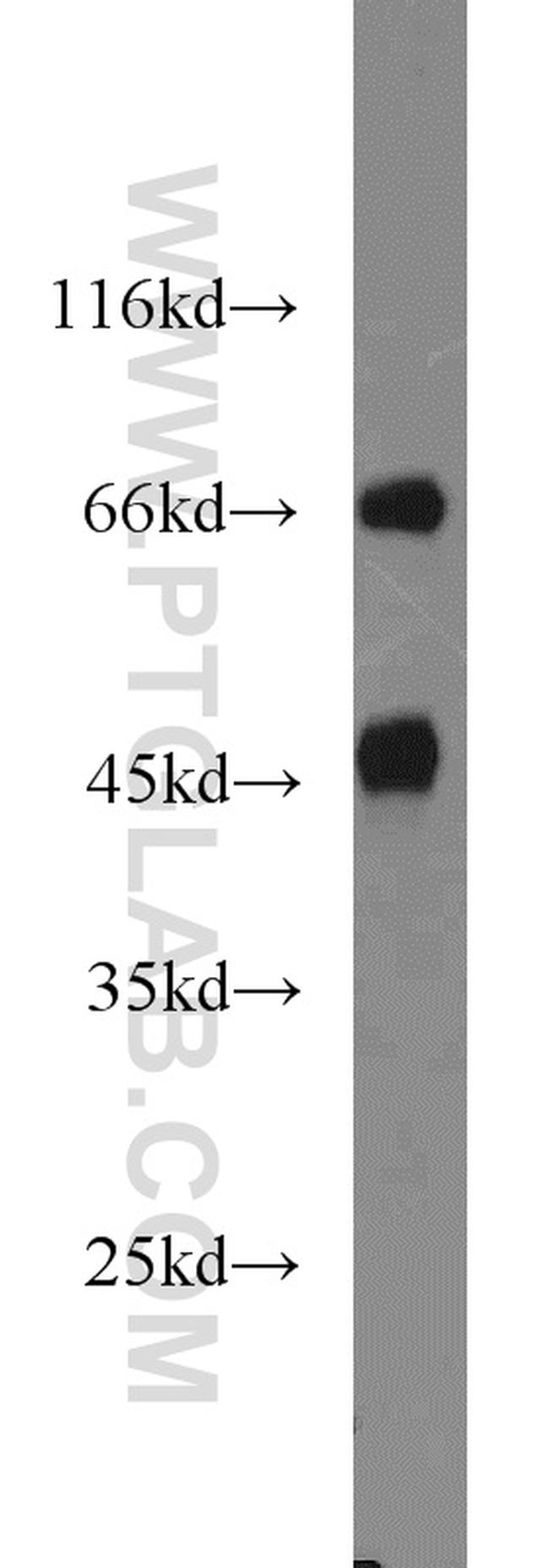 DARS2 Antibody in Western Blot (WB)