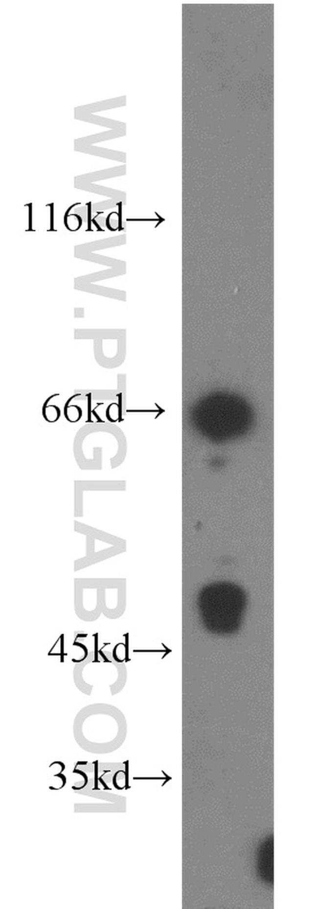 DARS2 Antibody in Western Blot (WB)