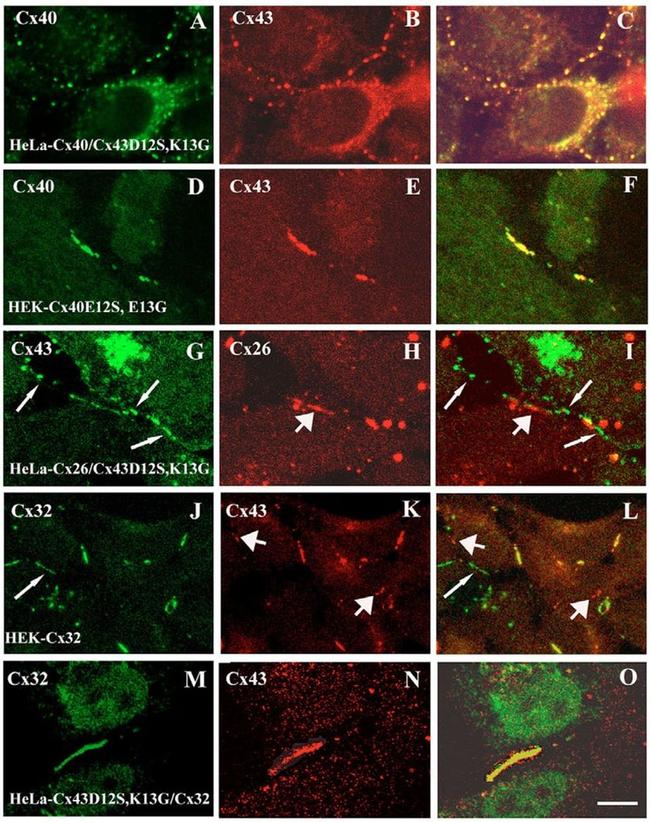 Connexin 26 Antibody in Immunocytochemistry (ICC/IF)