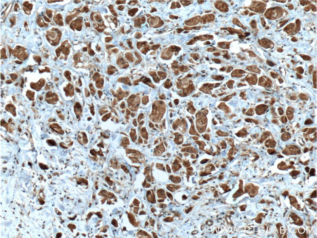 Pirh2 Antibody in Immunohistochemistry (Paraffin) (IHC (P))