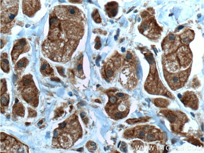 Pirh2 Antibody in Immunohistochemistry (Paraffin) (IHC (P))