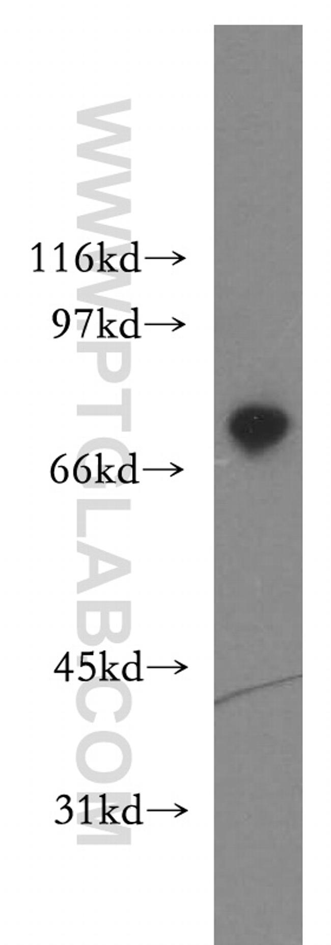TIGD1 Antibody in Western Blot (WB)