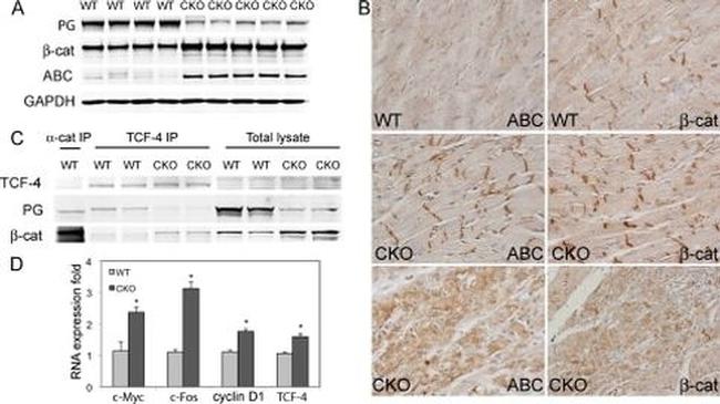 beta Catenin Antibody in Western Blot, Immunohistochemistry (WB, IHC)