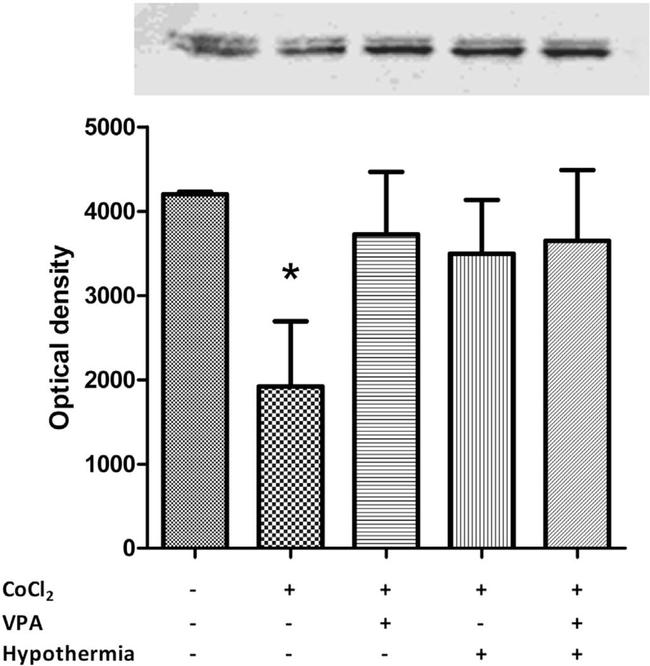 beta Catenin Antibody in Western Blot (WB)