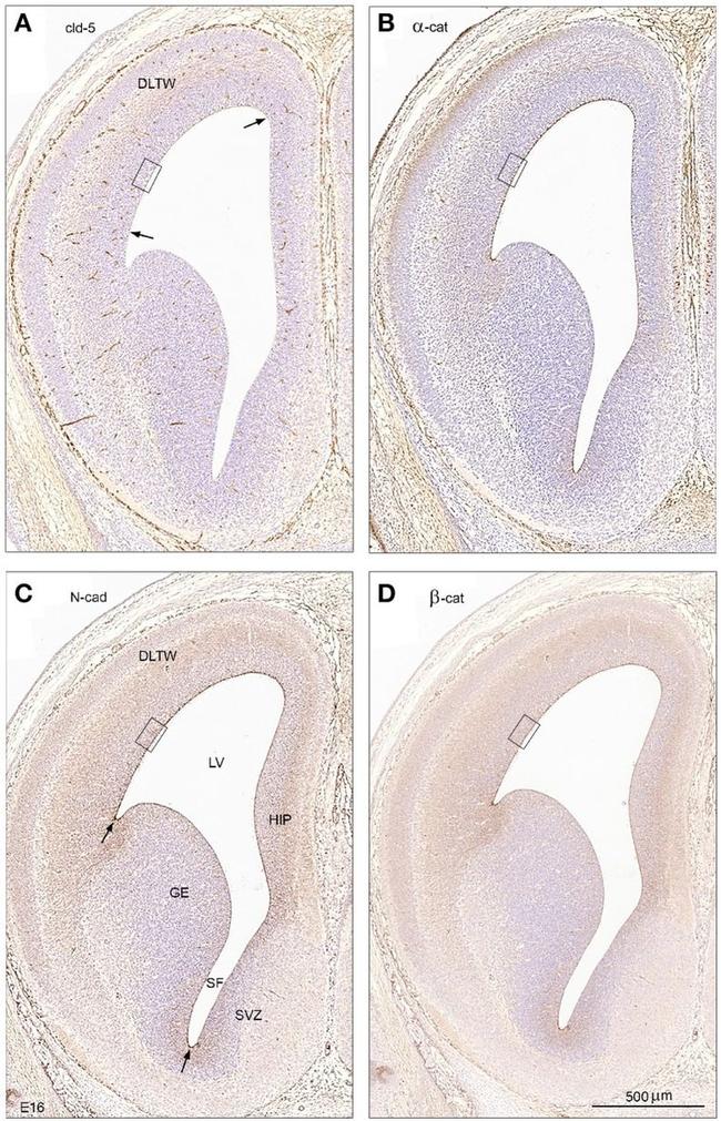 beta Catenin Antibody in Immunohistochemistry (IHC)