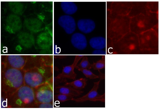 beta Catenin Antibody in Immunocytochemistry (ICC/IF)