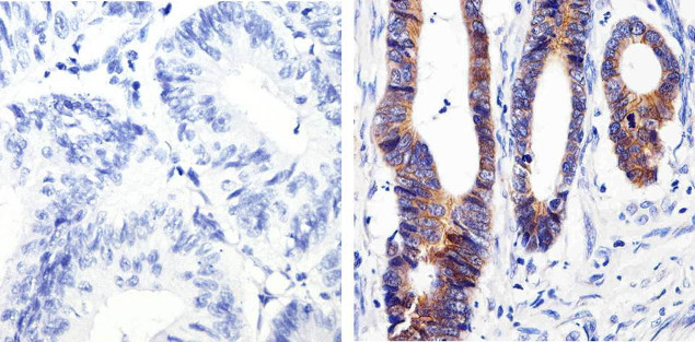 beta Catenin Antibody in Immunohistochemistry (Paraffin) (IHC (P))