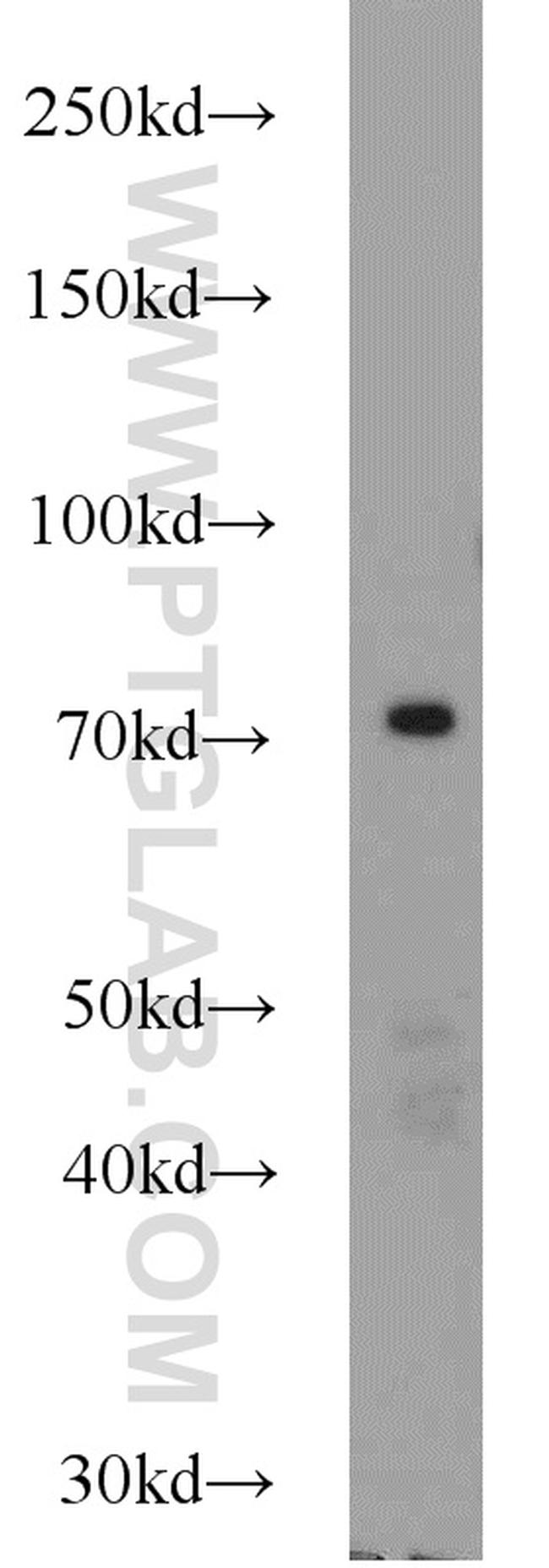 JAKMIP1 Antibody in Western Blot (WB)