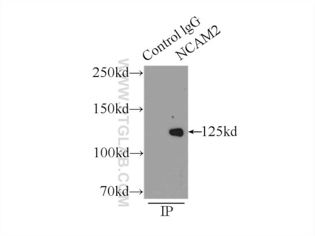 NCAM2 Antibody in Immunoprecipitation (IP)