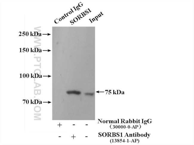 SORBS1 Antibody in Immunoprecipitation (IP)