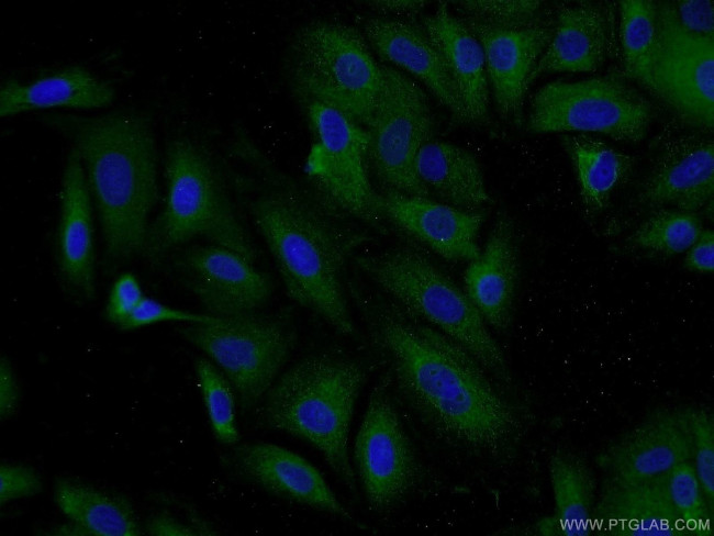 DCP1B Antibody in Immunocytochemistry (ICC/IF)