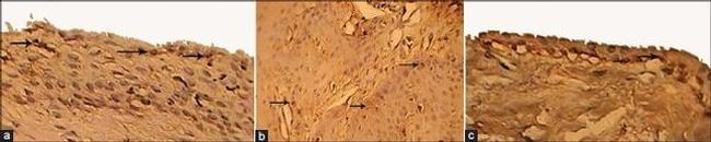 Bcl-2 Antibody in Immunohistochemistry (IHC)