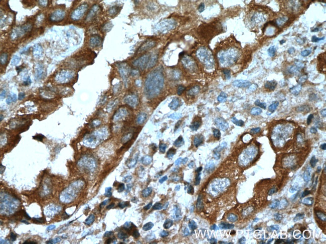 PKC iota Antibody in Immunohistochemistry (Paraffin) (IHC (P))