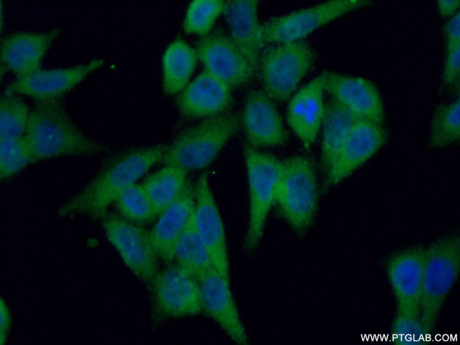 PKC iota Antibody in Immunocytochemistry (ICC/IF)