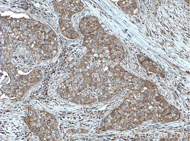 PKC iota Antibody in Immunohistochemistry (Paraffin) (IHC (P))