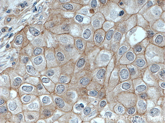 PKC iota Antibody in Immunohistochemistry (Paraffin) (IHC (P))