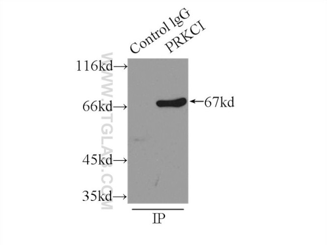 PKC iota Antibody in Immunoprecipitation (IP)