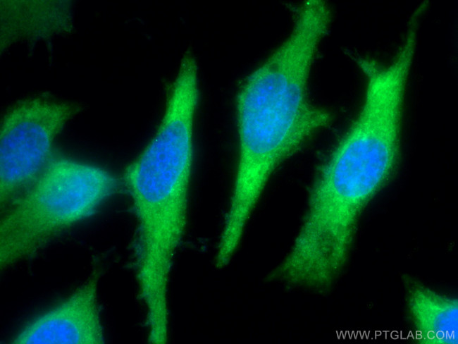 PKC iota Antibody in Immunocytochemistry (ICC/IF)