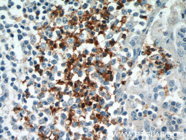 CX3CR1 Antibody in Immunohistochemistry (Paraffin) (IHC (P))