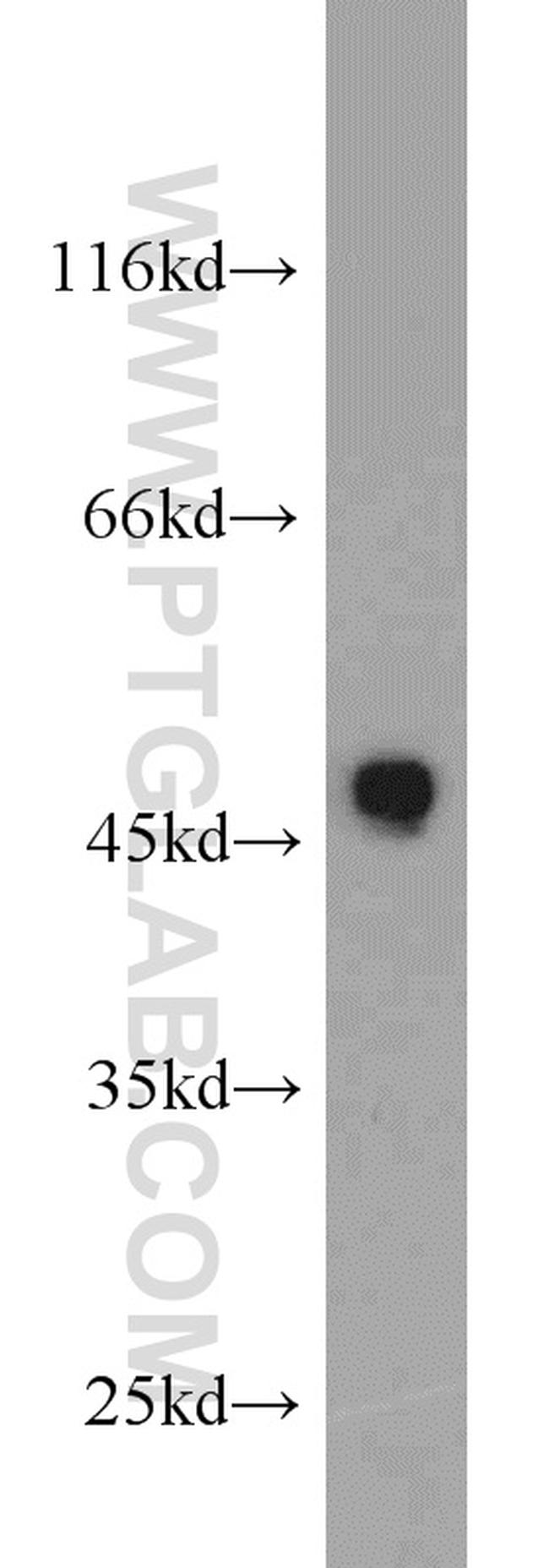 CX3CR1 Antibody in Western Blot (WB)